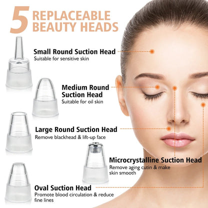 Electric Blackhead Remover Vacuum – Professional Pore Cleaner & Acne Removal Kit