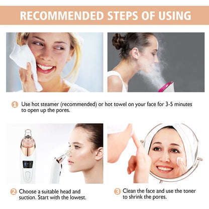 Electric Blackhead Remover Vacuum – Professional Pore Cleaner & Acne Removal Kit